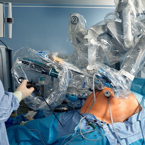 Cirurgia com sistema robótico em centro cirúrgico, com médico operando equipamentos minimamente invasivos sobre paciente em mesa operatória.