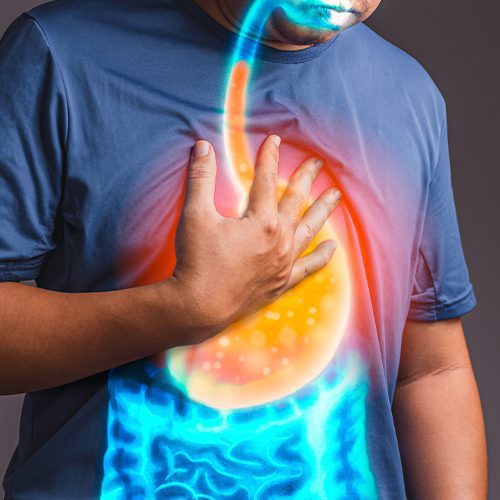 Homem com a mão no peito e ilustração do sistema digestivo em destaque, representando sintomas de refluxo gástrico.